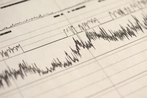 What Happens During a Sleep Study? stock image of results from a sleep study